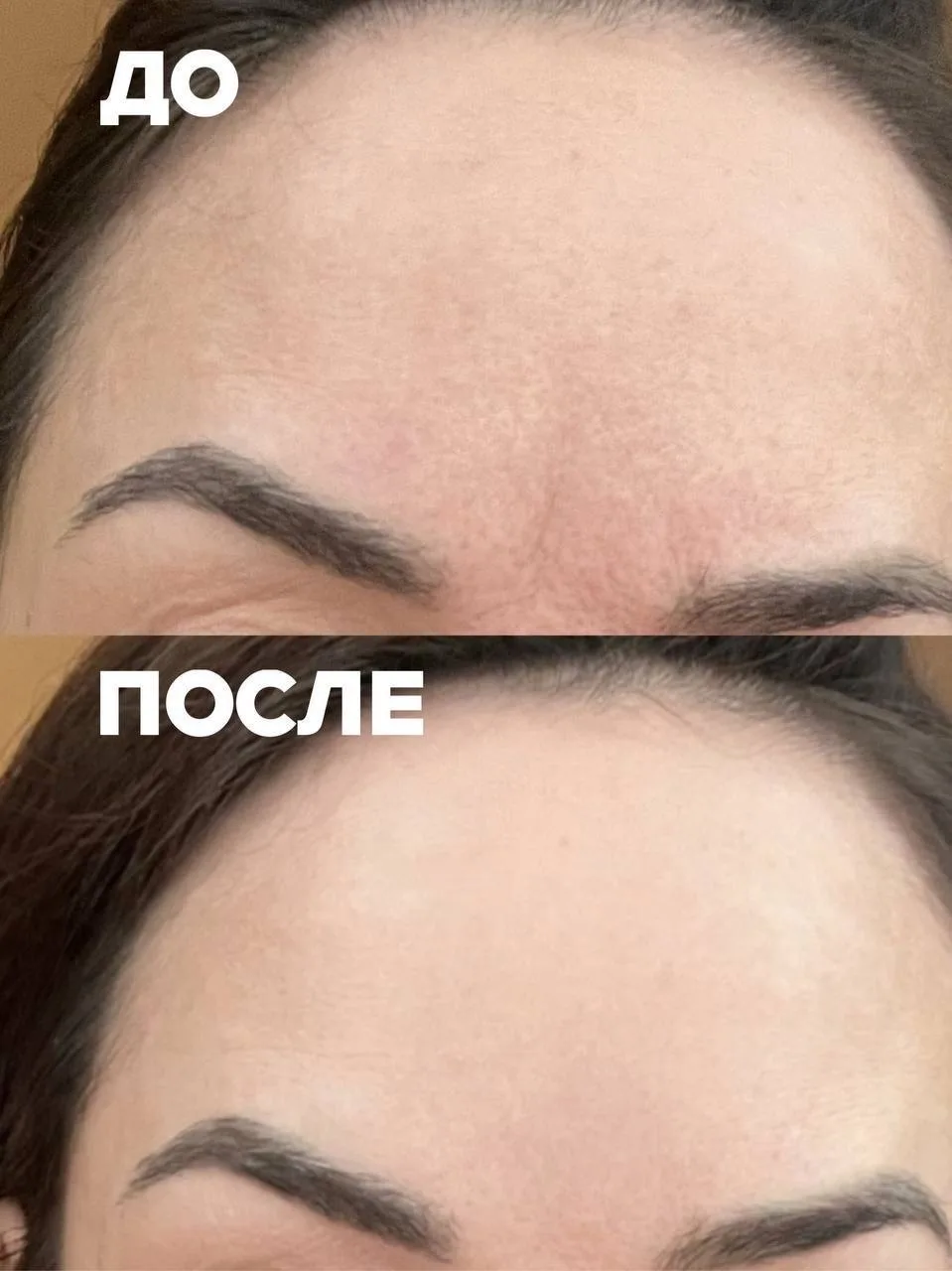 Топ рекомендация для всех, кто, как и я, не любит уколы - бустер-флюид в супер удобном ...