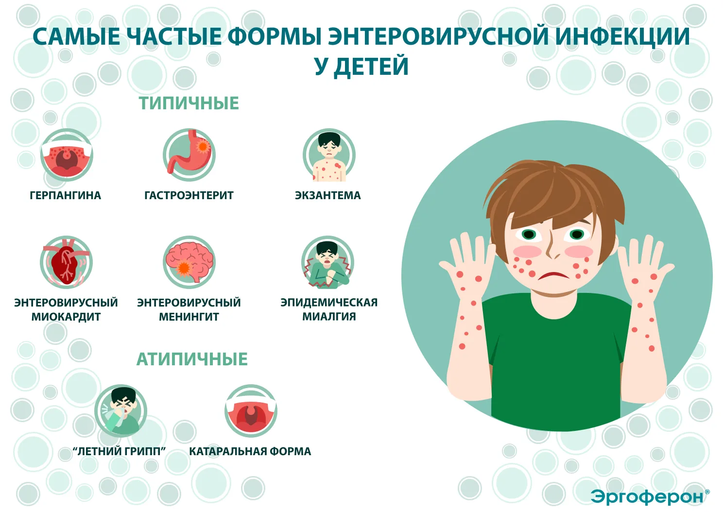 Энтеровирус: как распознать и что делать?

 - Как понять, что это энтеровирус?

Симптомы могут быть 