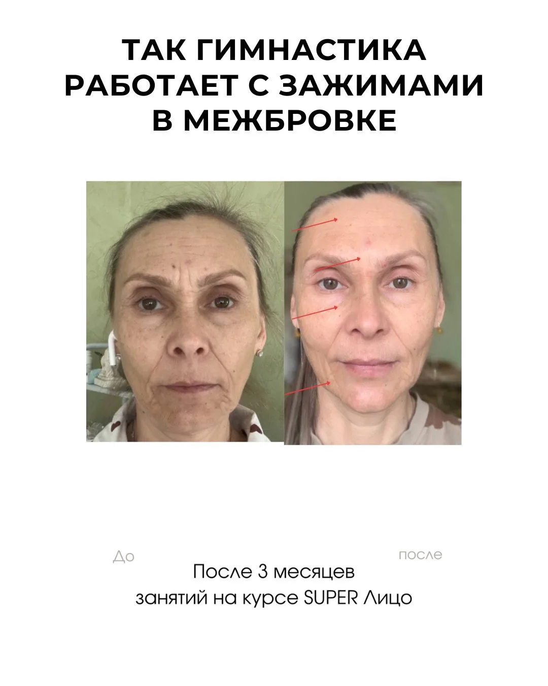 Изображение 2 к публикации «Гимнастика для лица»