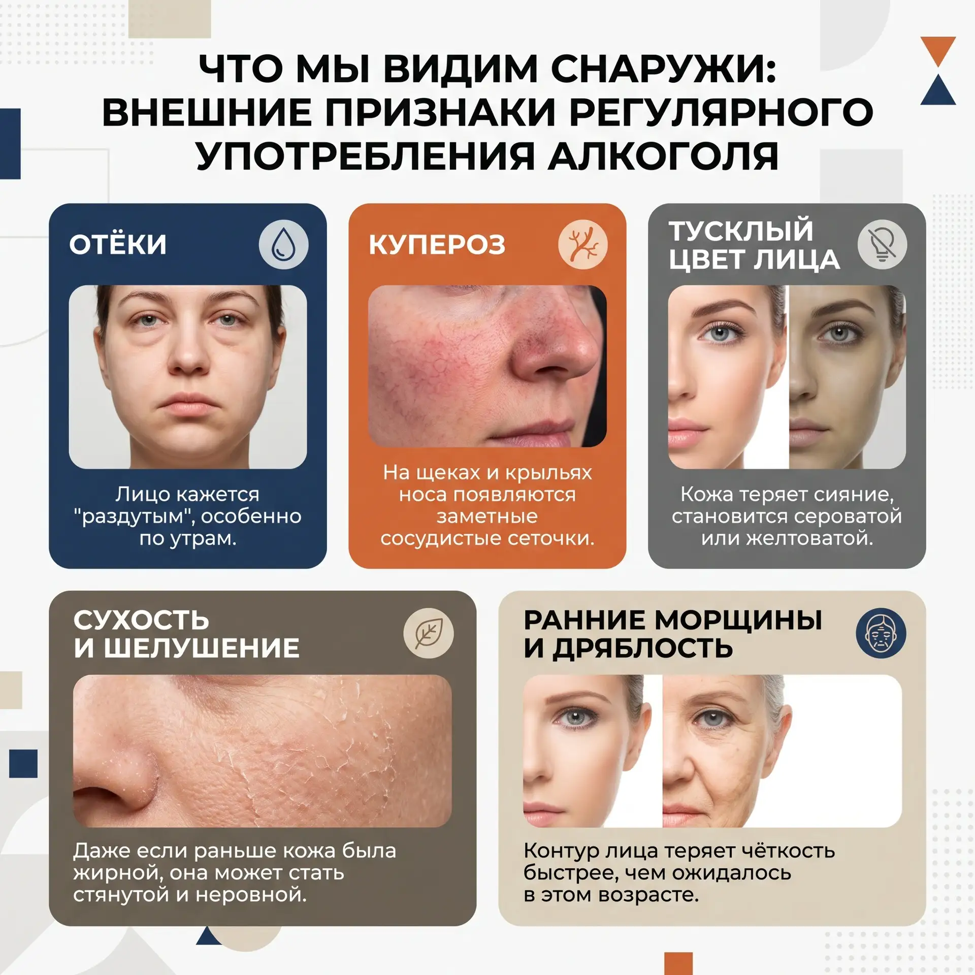 🧖 Как алкоголь «старит» кожу и сосуды: взгляд специалиста Большереченской ЦРБ