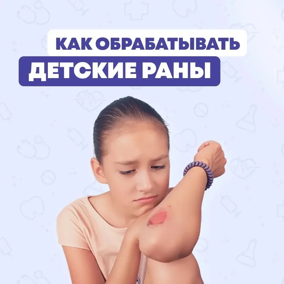 Летом активный отдых часто приводит к царапинам и ссадинам.

В карточках рассказали, как правильно и