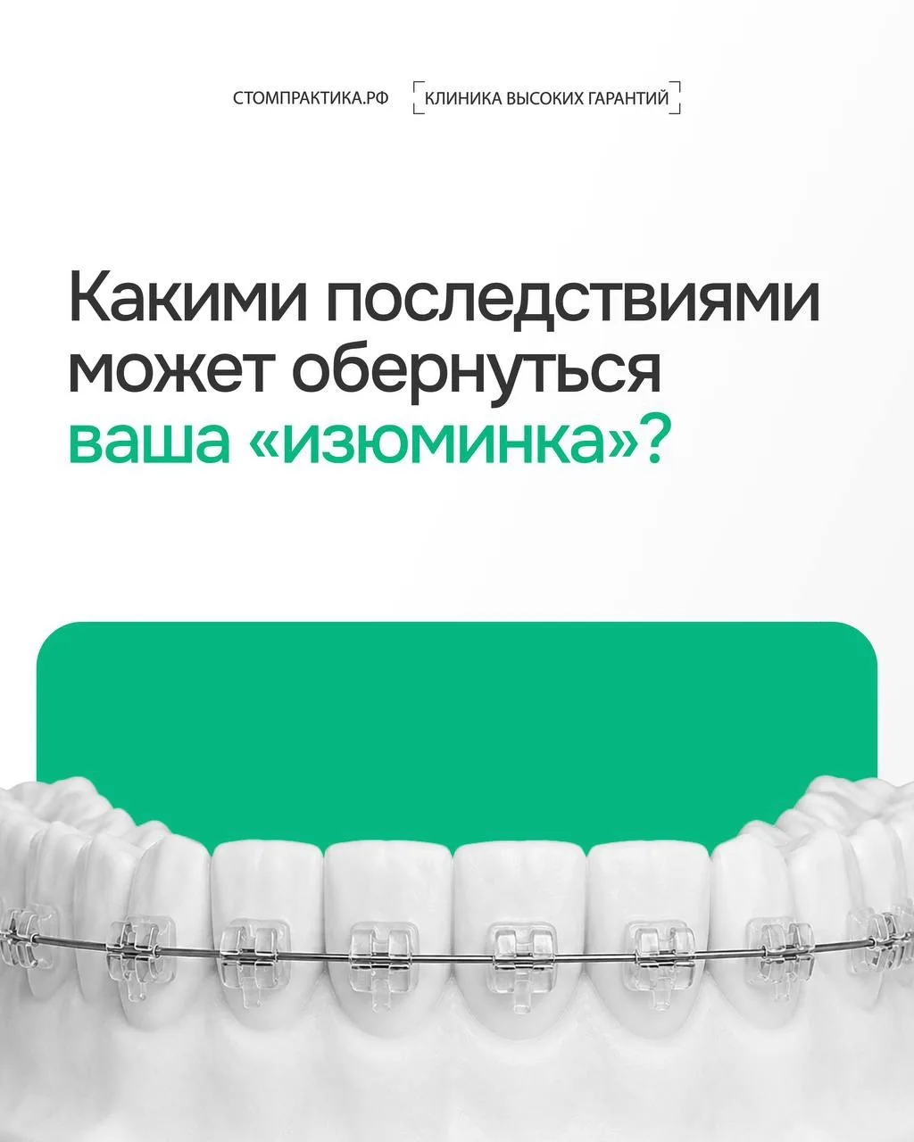 «Да нормально у тебя всё с зубами. Это твоя изюминка».