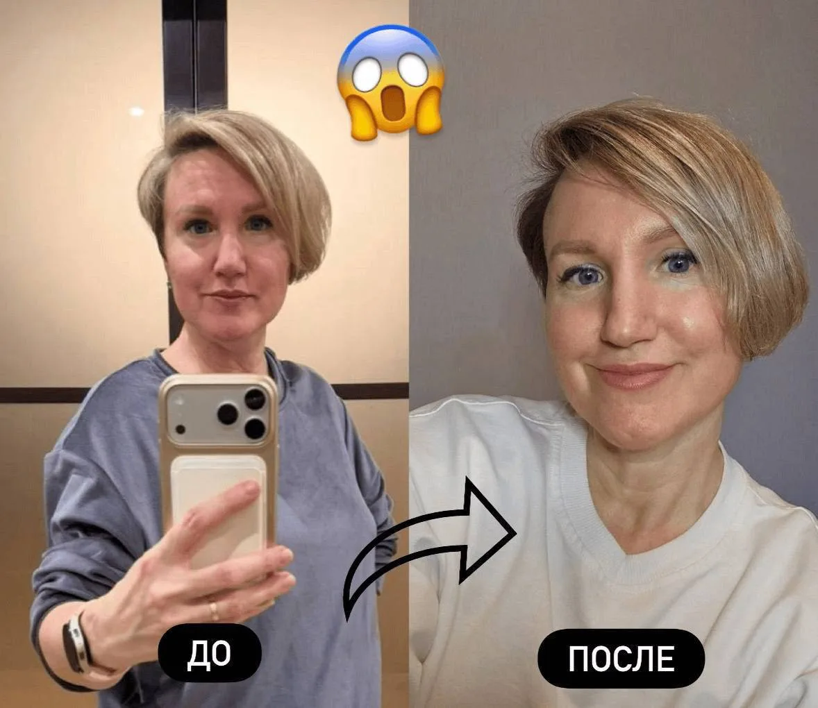 ДО/ПОСЛЕ ИСПОЛЬЗОВАНИЯ ПЕПТИДОВ

😱 Девочки, вы тоже видите эти перемены?

Я протестировала пептиды 