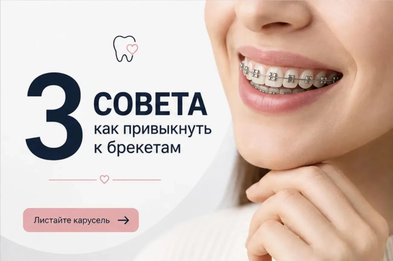 🦷 3 совета, как привыкнуть к брекетам