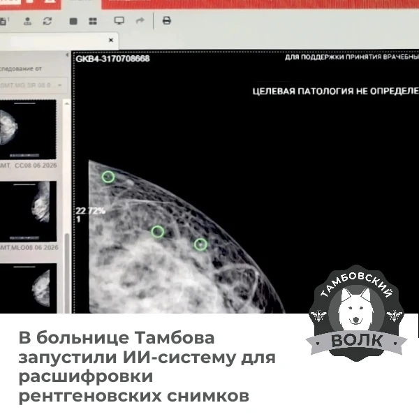 🏥💻 В тамбовской больнице №4 ИИ анализирует рентген-снимки

В отделении лучевой диагностики заработ