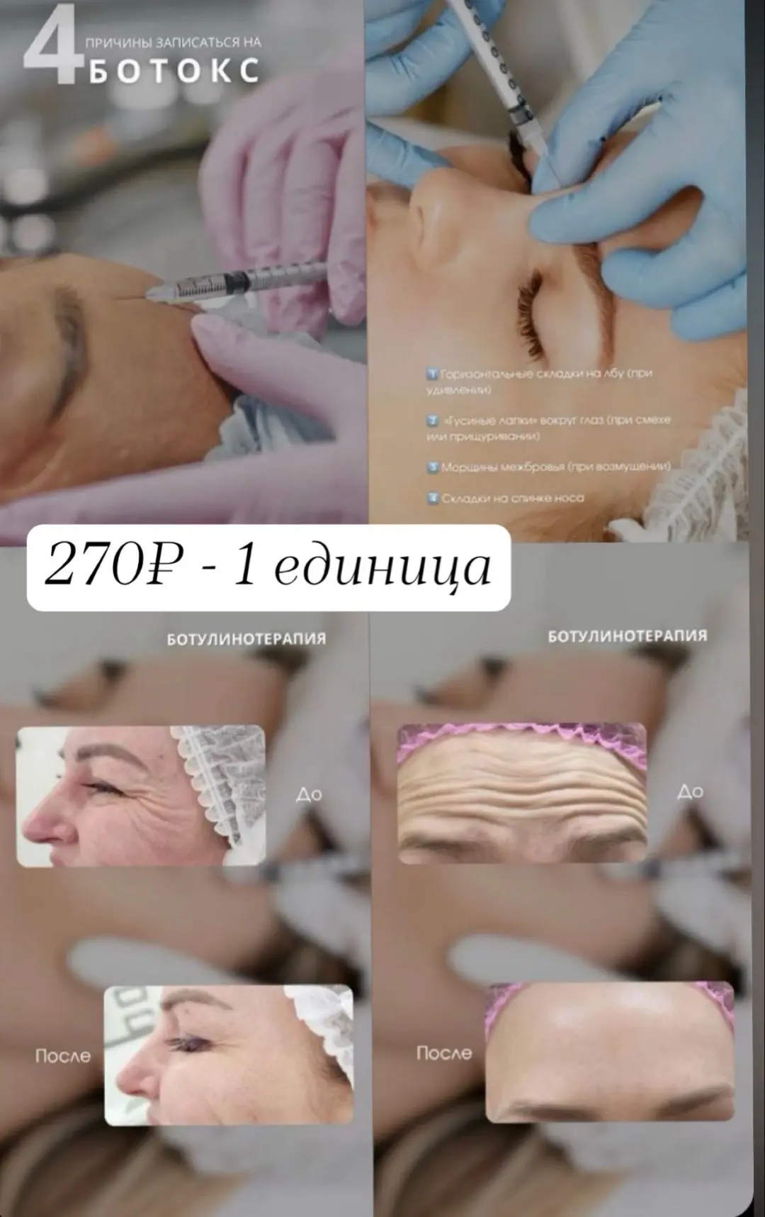 Выражайте эмоции свободно, не думая о морщинах! ✨