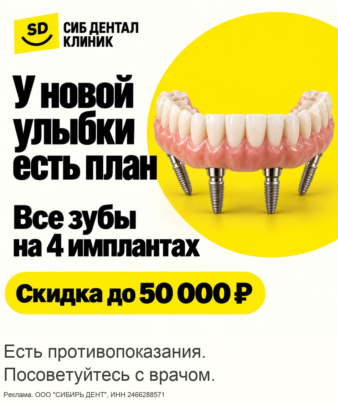 Все зубы на 4 имплантах. Улыбка начинается с плана!