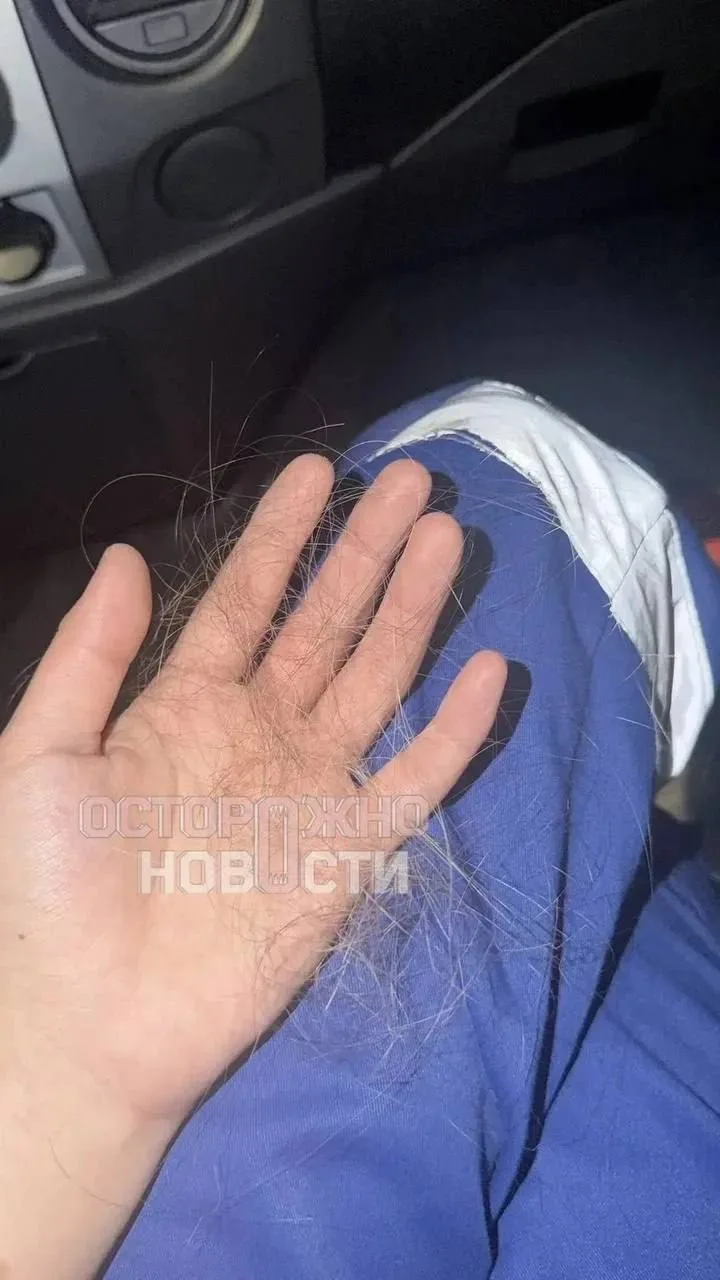 В Пятигорске возбудили уголовное дело после нападения на фельдшера скорой помощи

По данным следстви
