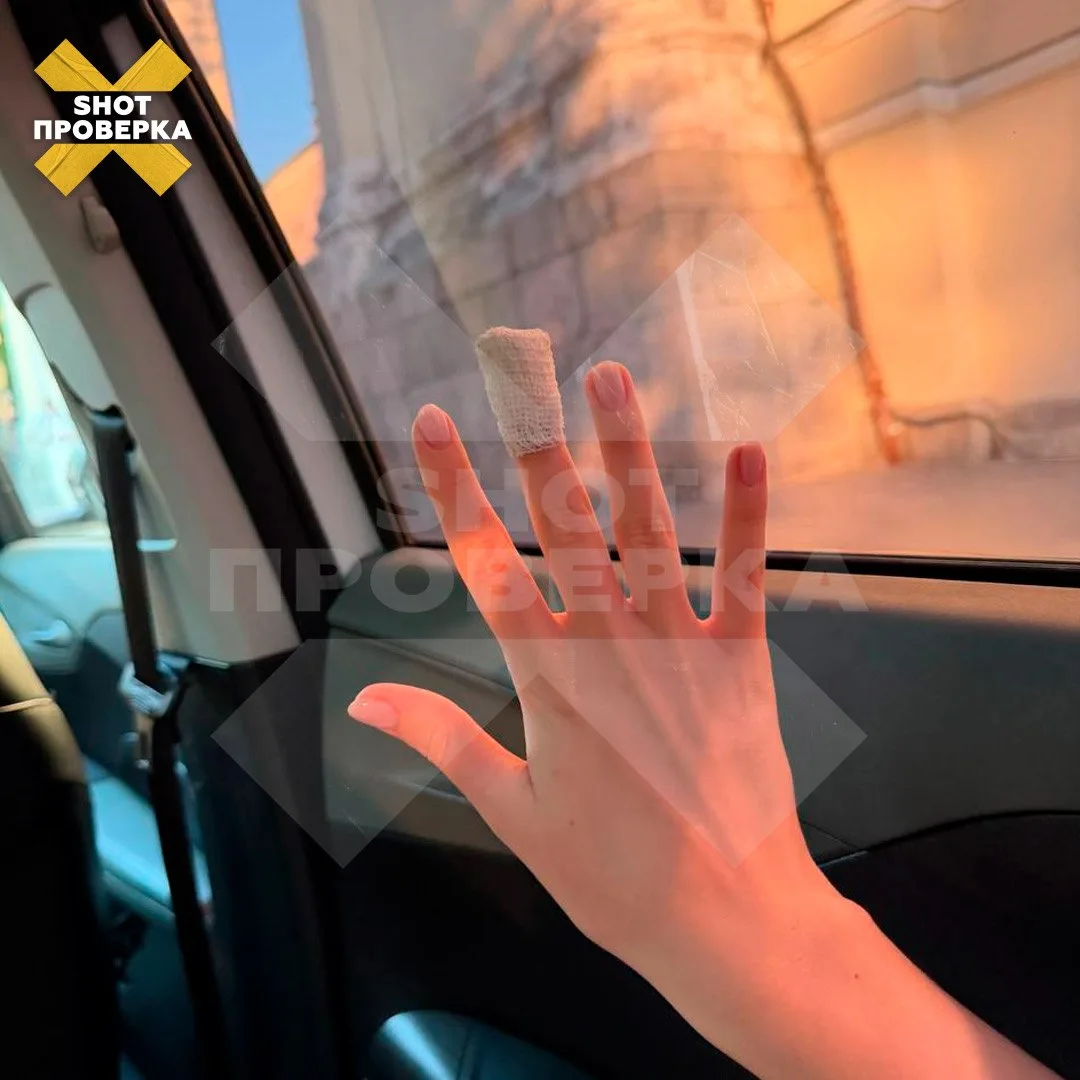 В гнойную хирургию попала москвичка после маникюра в салоне Sky Nails — во время процедуры ей повред