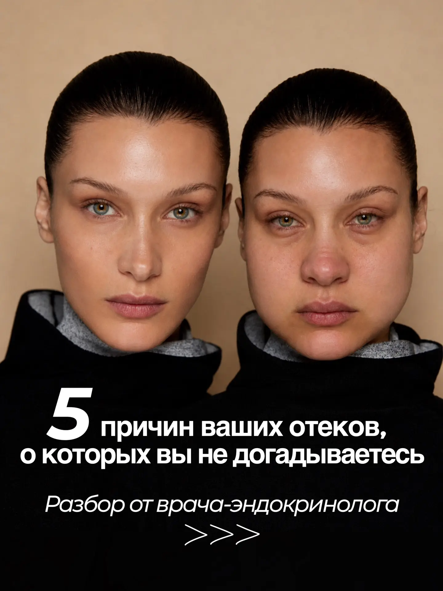 💧5 неочевидных причин почему вы отекаете💧

Для того, чтобы грамотно разобраться в причинах отеков 