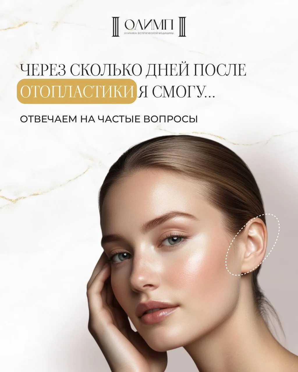 Через какое время после отопластики можно вернуться к привычной жизни?