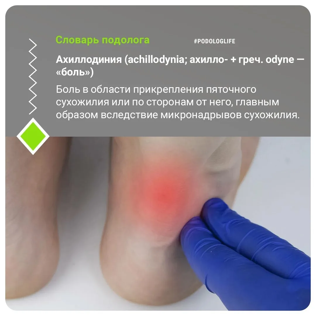 #словарподолога #словарьподологлайф #словарьподологлайф