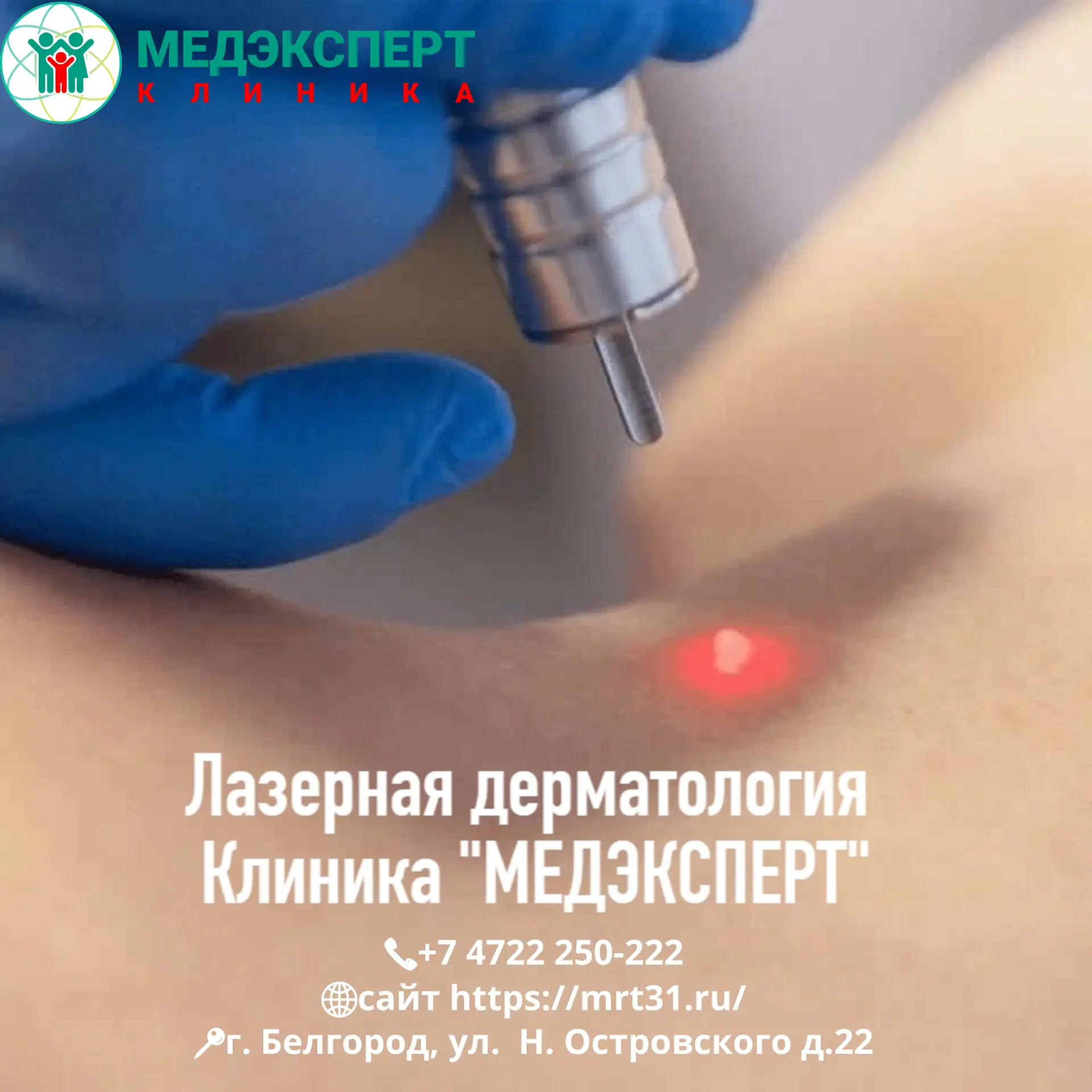 Лазерные технологии в дерматологии все чаще находят применение, по сравнению с другими ...