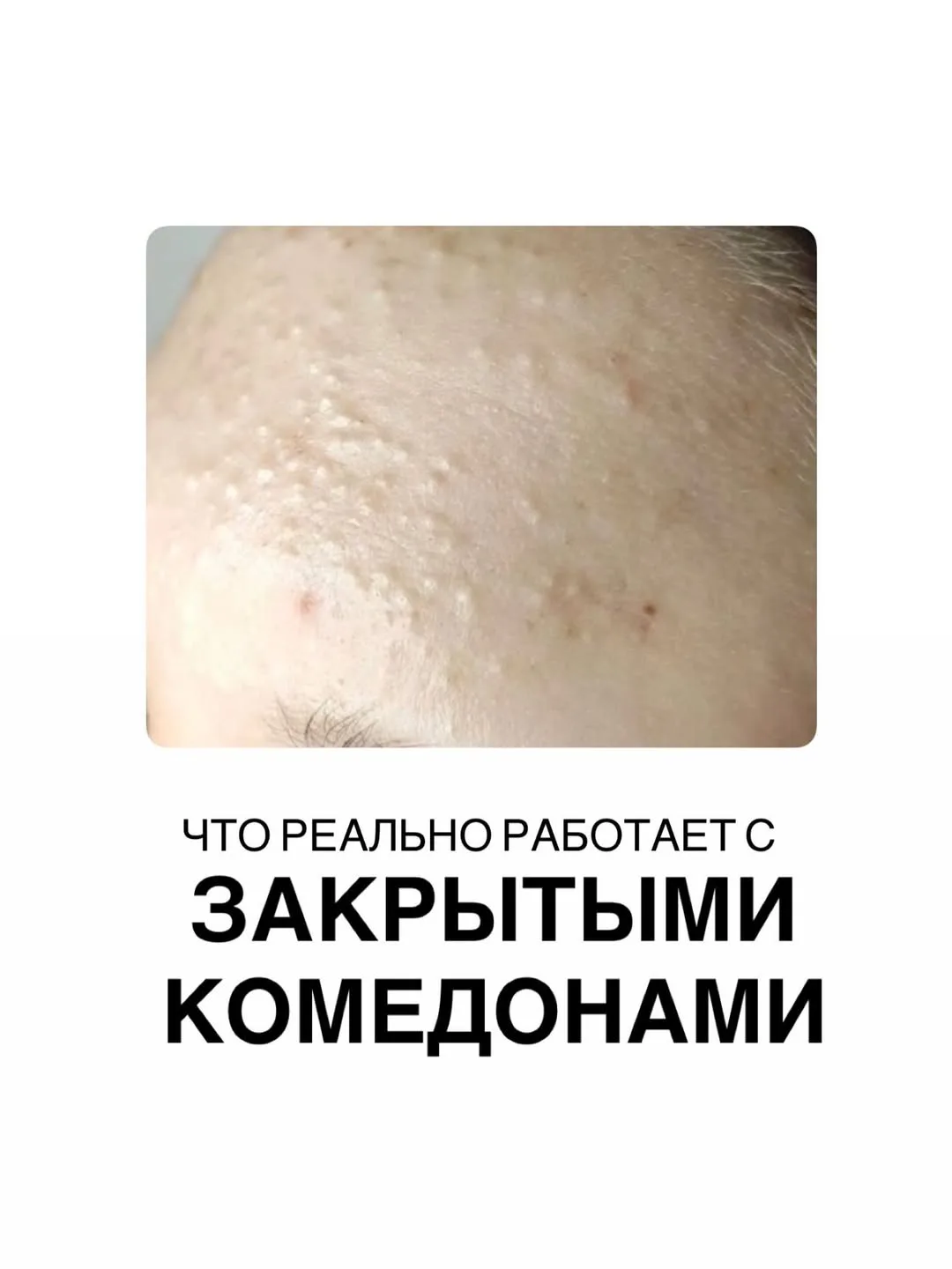 Главный принцип здесь простой: регулярность и умеренность. А в погоне за быстрыми результатами легко