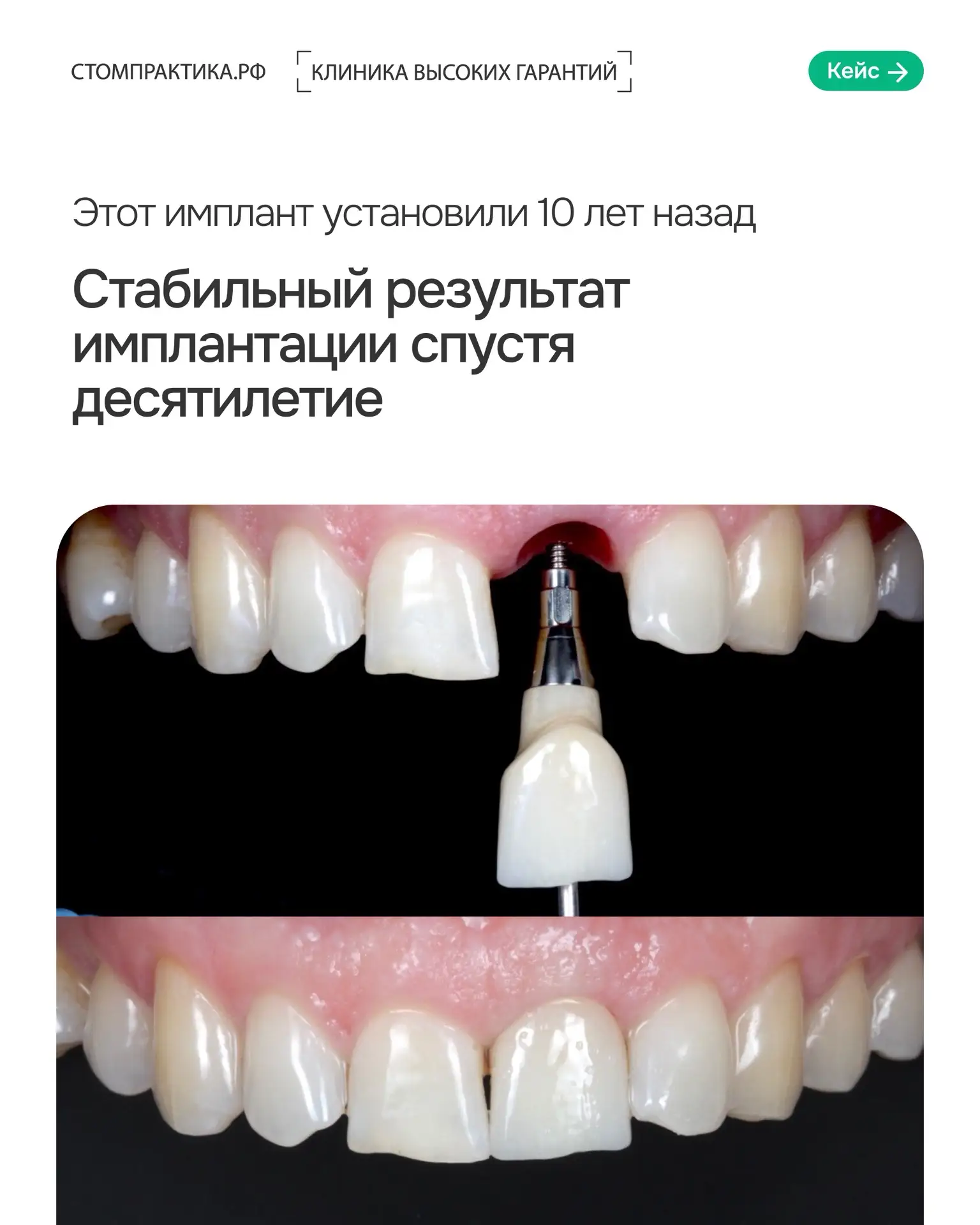 Стомпрактика.рф – центр имплантации, где технологии, опыт врачей и безопасность пациент...