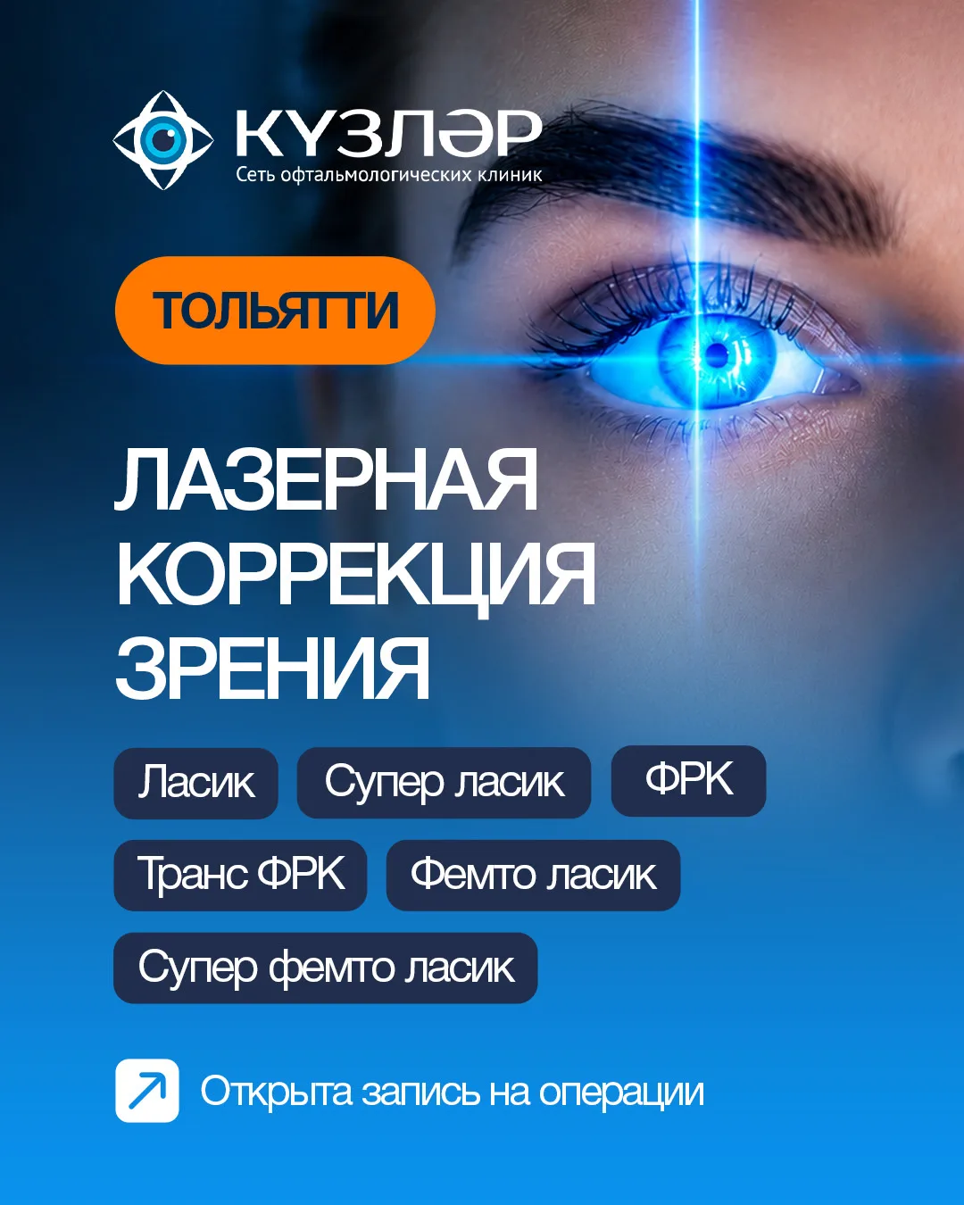 ЛАЗЕРНАЯ КОРРЕКЦИЯ ЗРЕНИЯ
 📍ТОЛЬЯТТИ 

Теперь лазерная коррекция зрения доступна в клинике Кузляр в