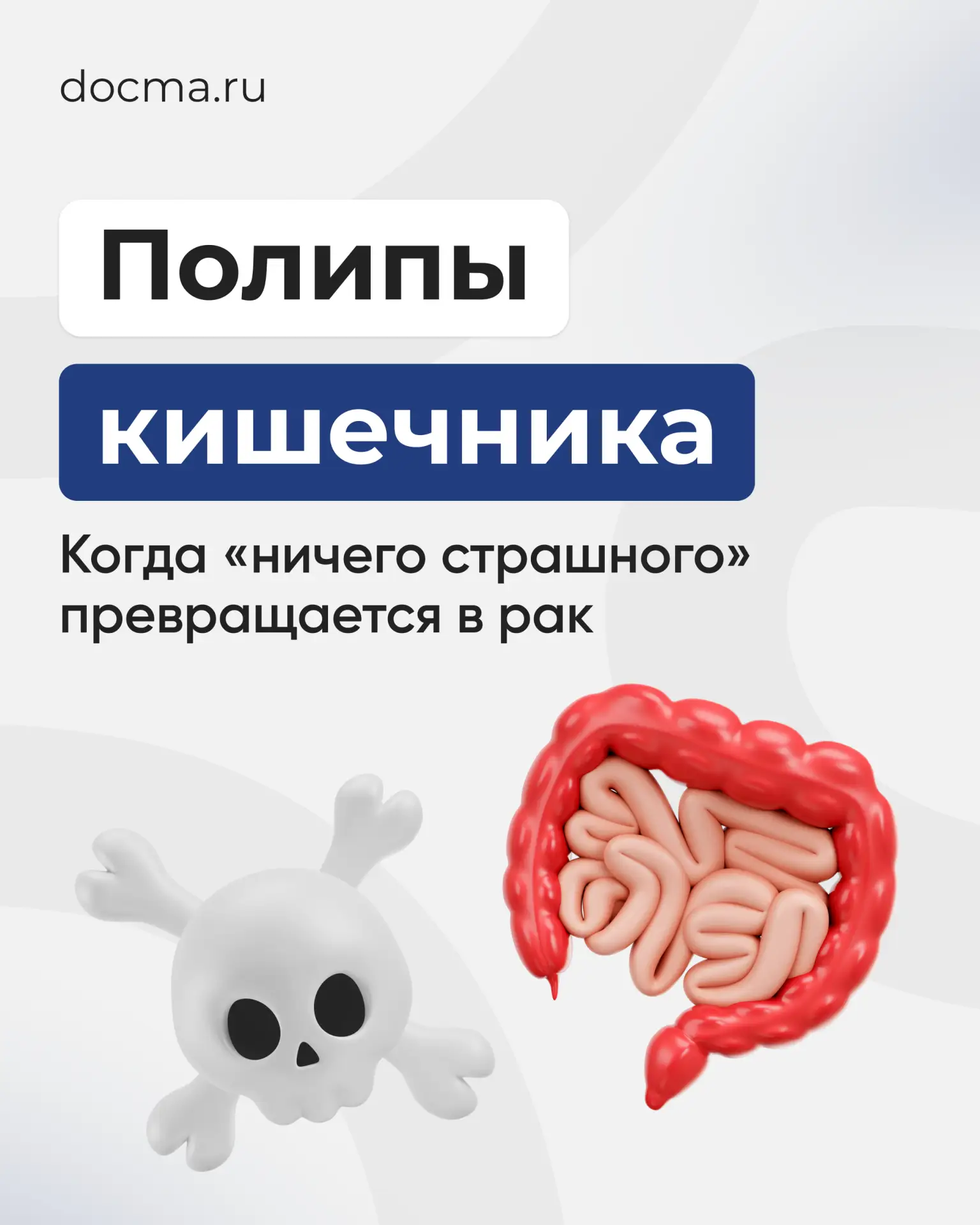 Полипы кишечника: когда «ничего страшного» превращается в рак