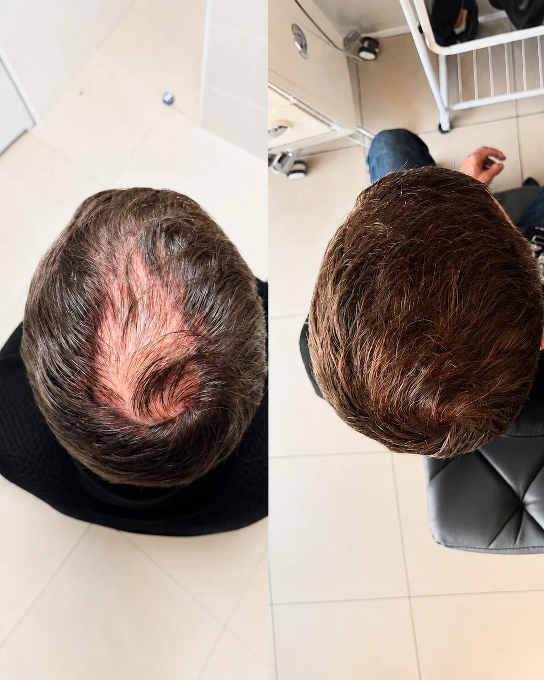 Еще один результат, который говорит сам за себя. 👨‍⚕️