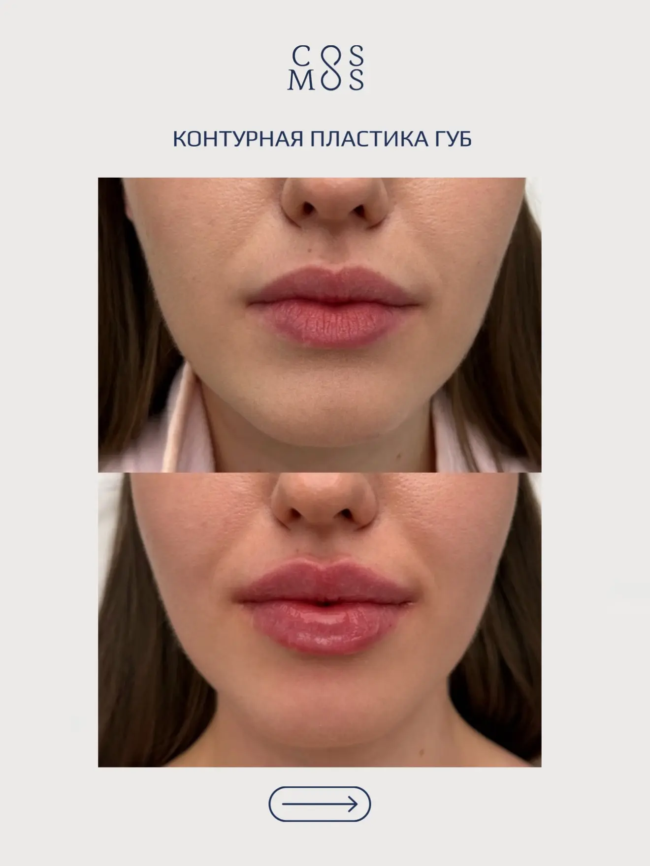 Делимся последними работами наших специалистов👇🏻