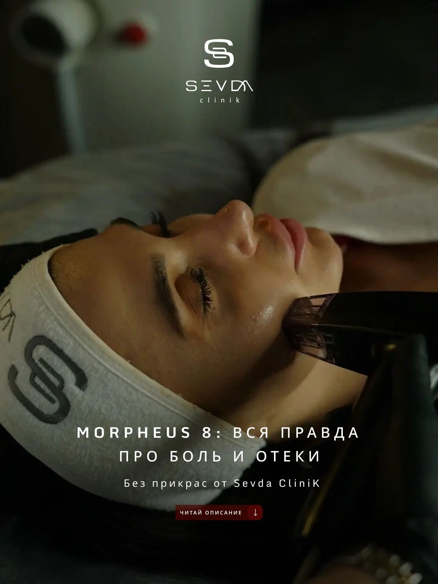 Честно об игольчатом RF Morpheus 8: будет ли больно и сколько сидеть дома?