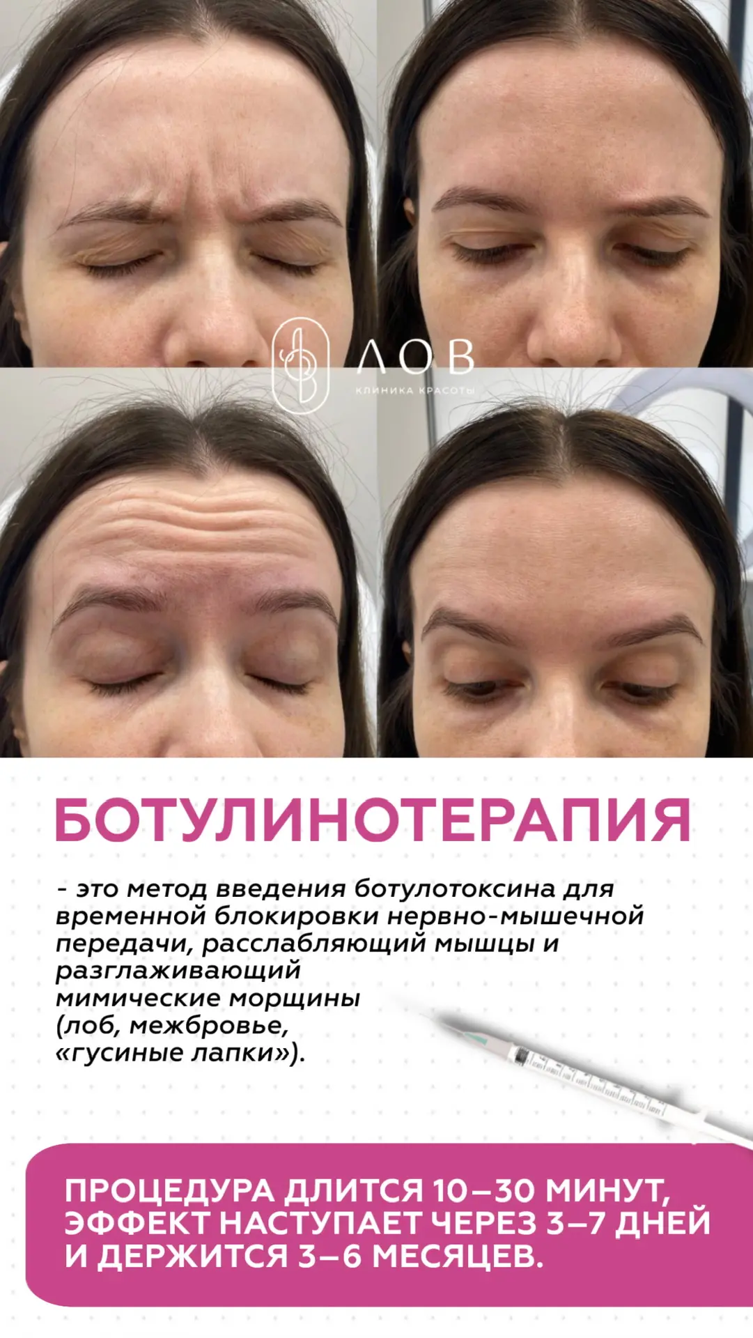 Влажные подмышки… убираем 
Запах пота… убираем 
Мокрые следы на одежде… убираем

До конца июня стоим