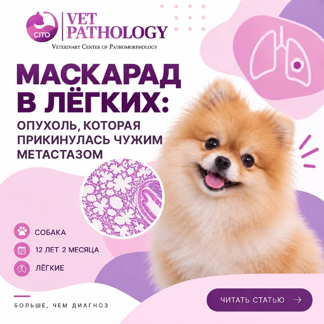 «Маскарад в легких: опухоль, которая прикинулась чужим метастазом» 🎭