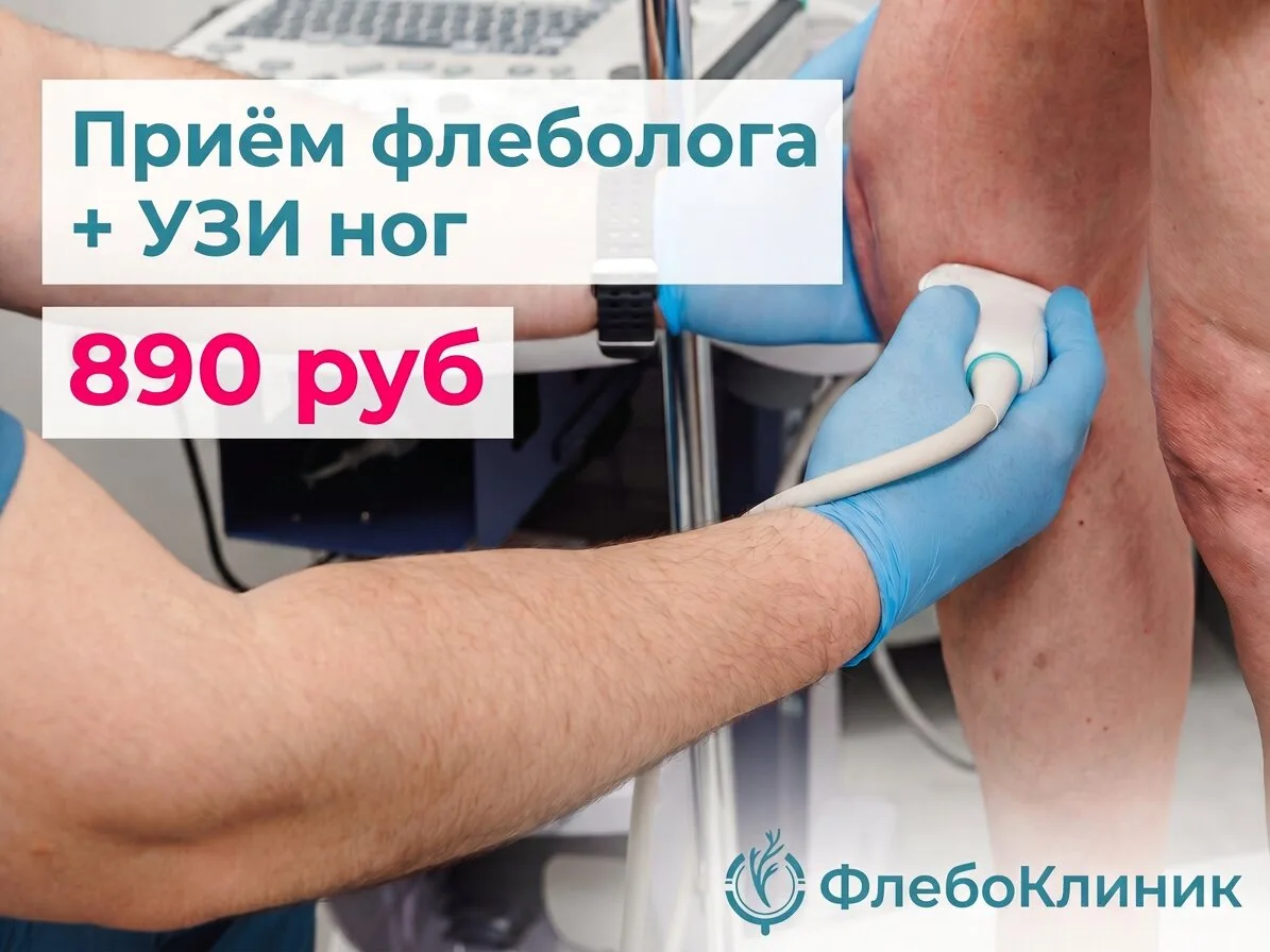 Прием флеболога с УЗИ диагностикой за 890 руб