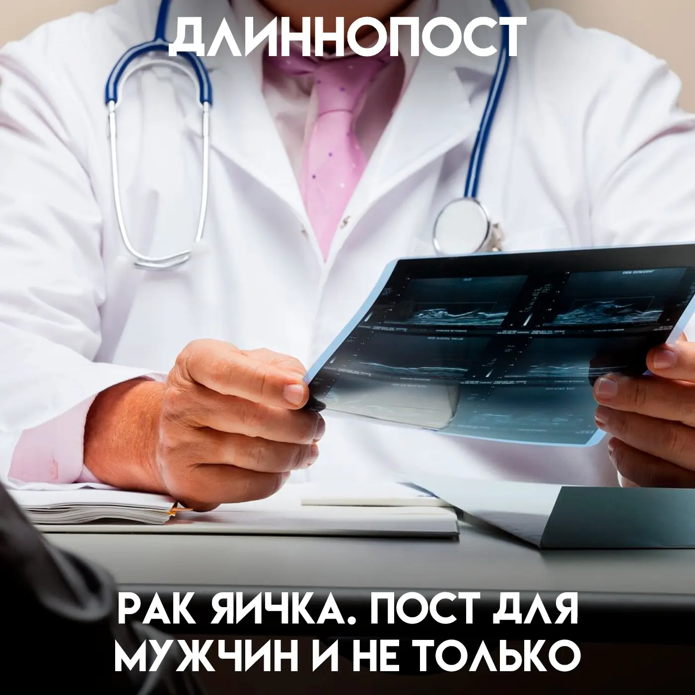 Осенью 2023 года, когда его сыну было всего три месяца, автор нащупал уплотнение, которого там быть 