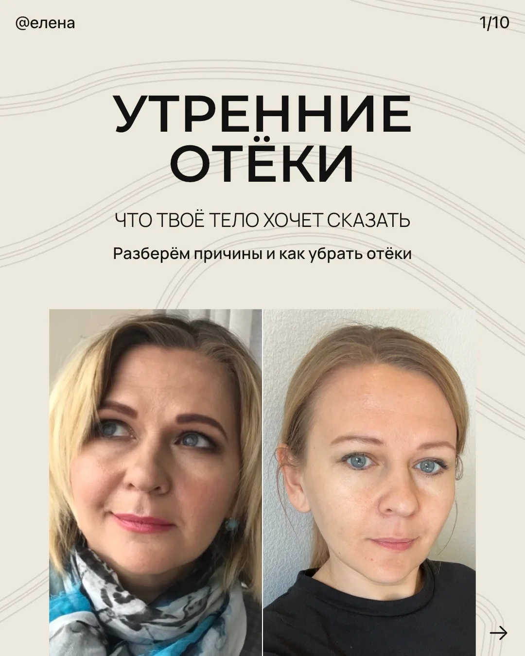 «Я так выгляжу с утра всегда, да это у всех так, это нормально…» НЕТ❌