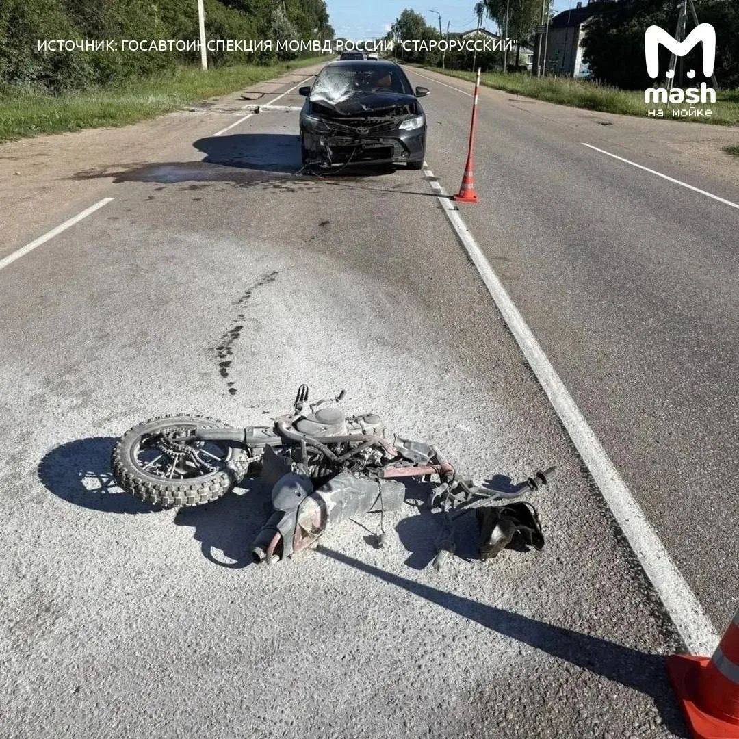😥17-летнего водителя питбайка с почти 100% ожогов тела пытаются спасти врачи питерского Педиатричес