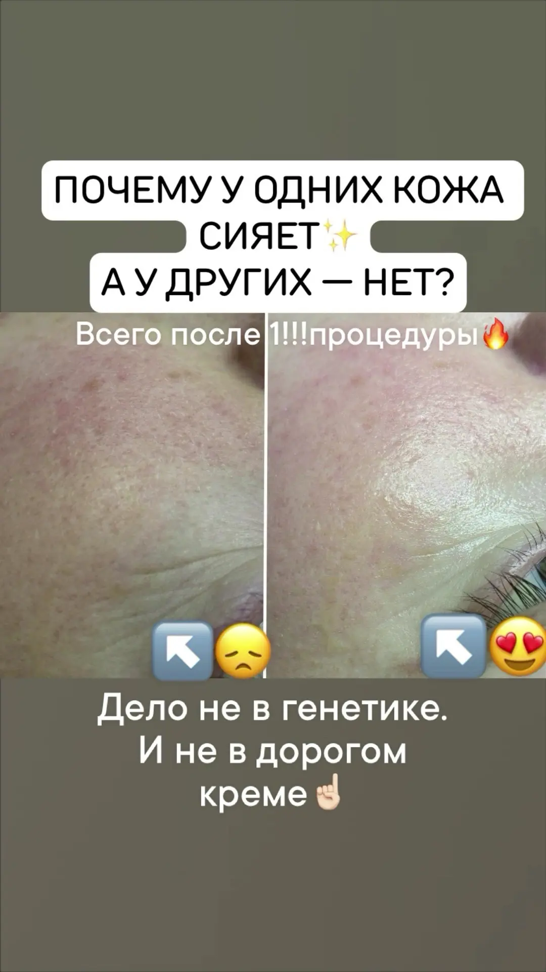 Чаще всего причина в регулярности и правильной последовательности💯