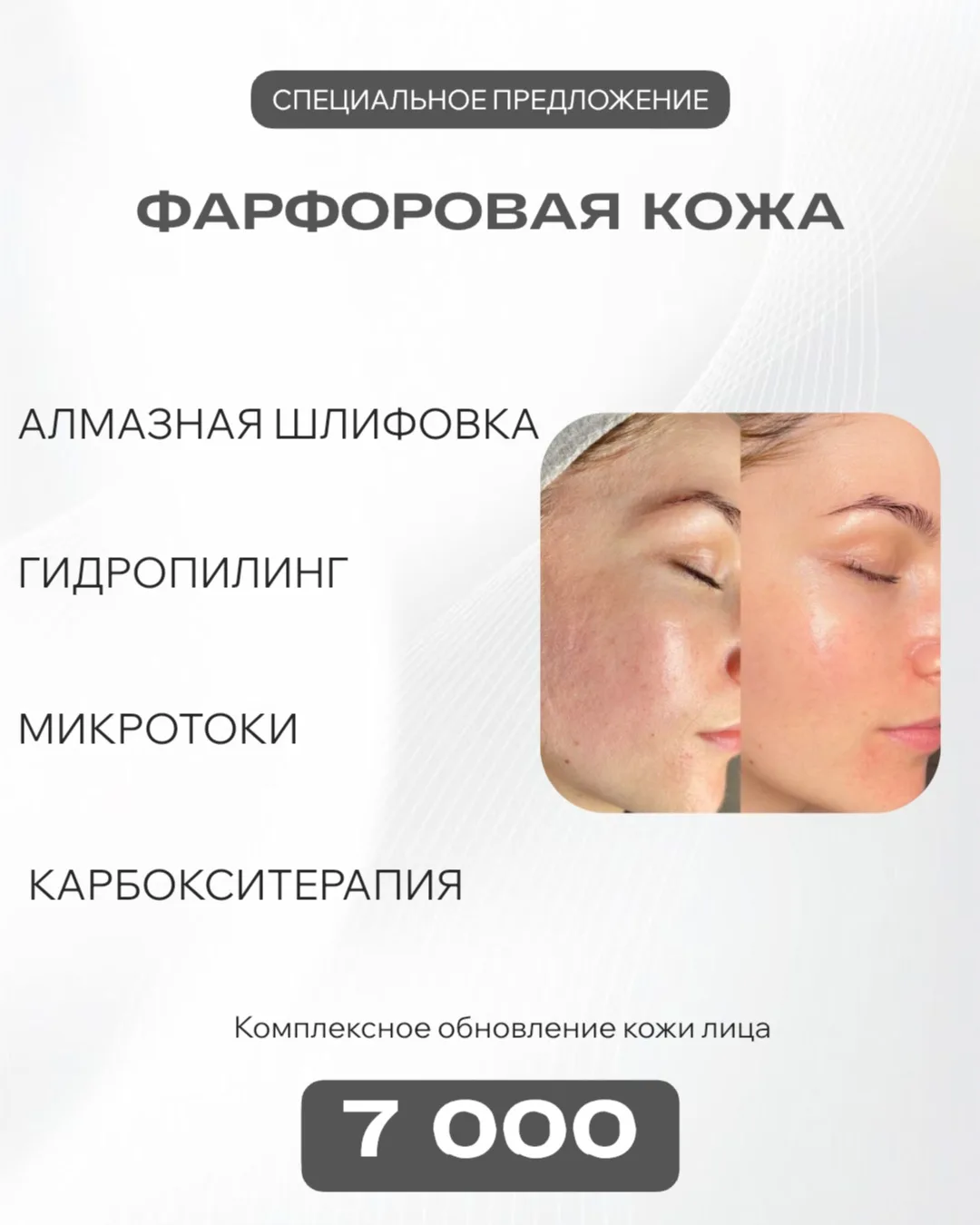 🤍 «Фарфоровая кожа»