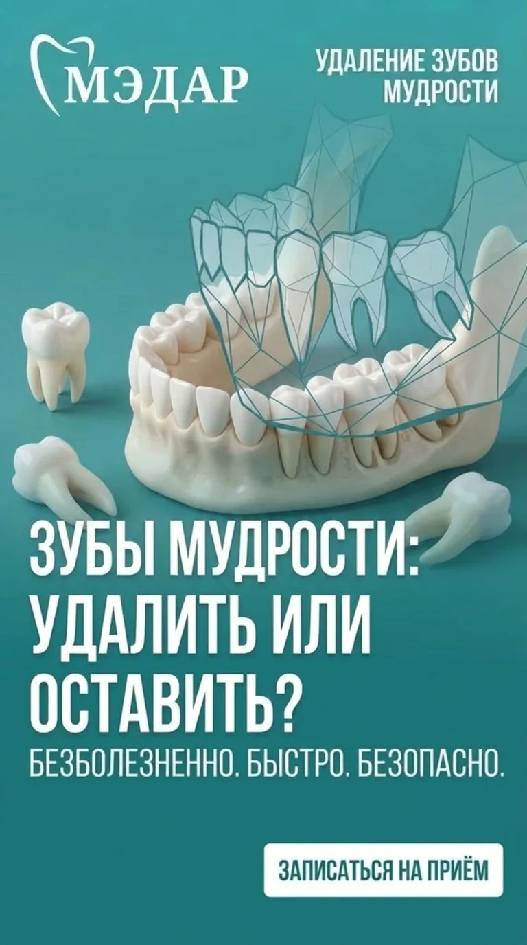 🦷5 сигналов, что пора к хирургу.