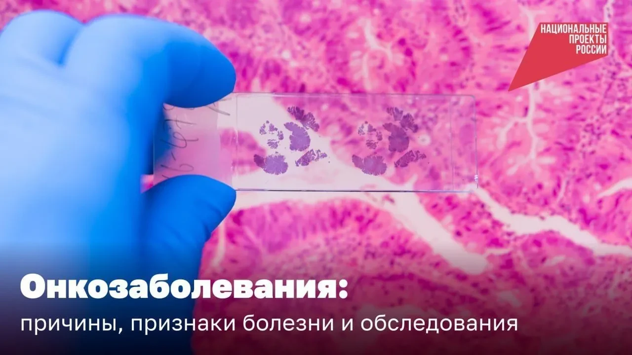 🏥 Борьба с онкологическими заболеваниями в рамках реализации национального проекта "Пр...