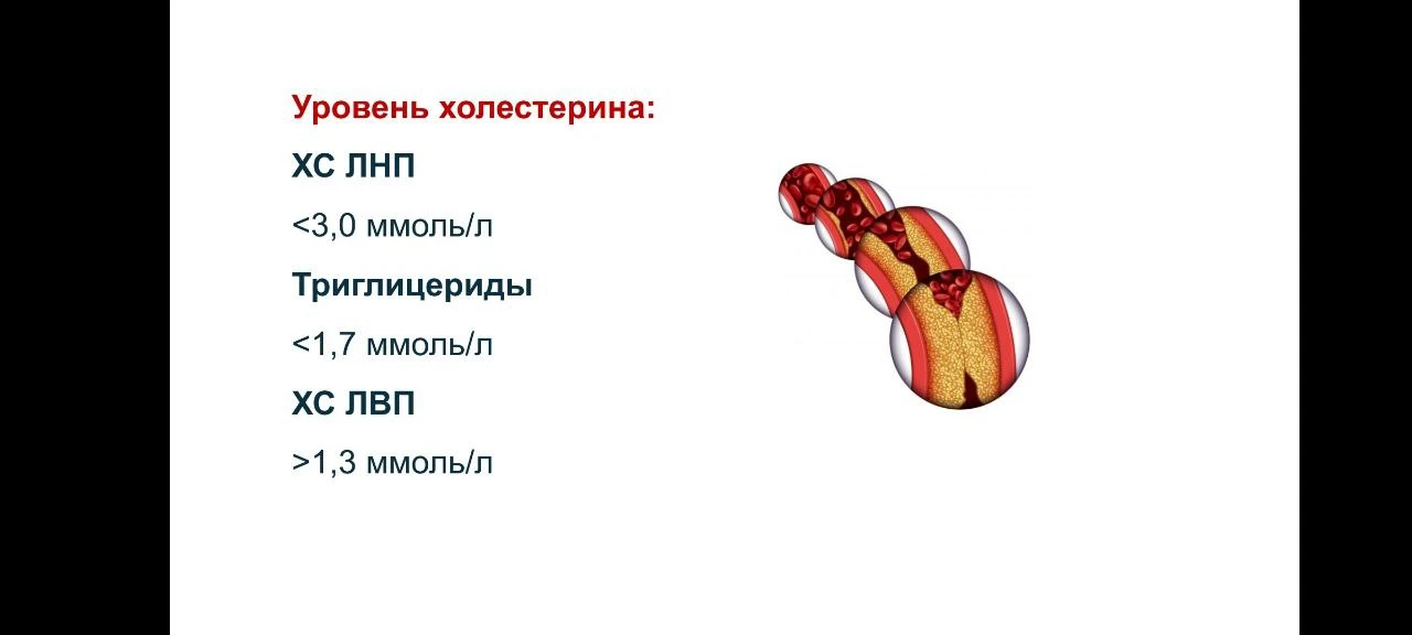 Приведи в норму 6 этих простых показаталей, это поможет сохранить здоровье и молодость сердца, сосуд