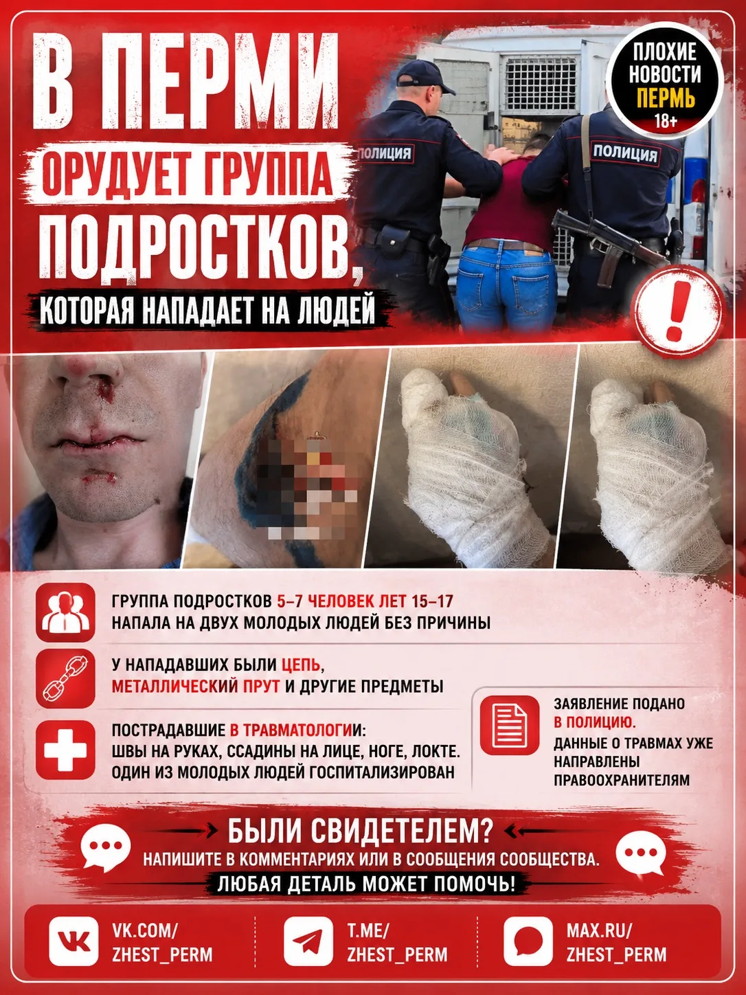 👊 В центре Перми неизвестные подростки избили двух молодых людей

В редакцию обратился читатель, ко