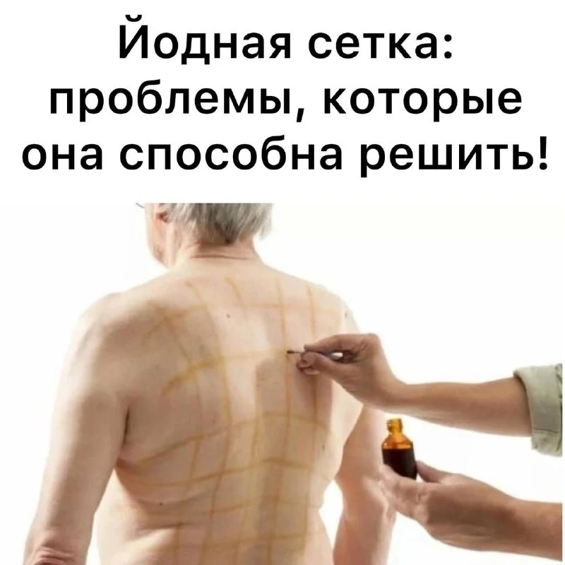 Йодная сетка: проблемы, которые она способна решить!