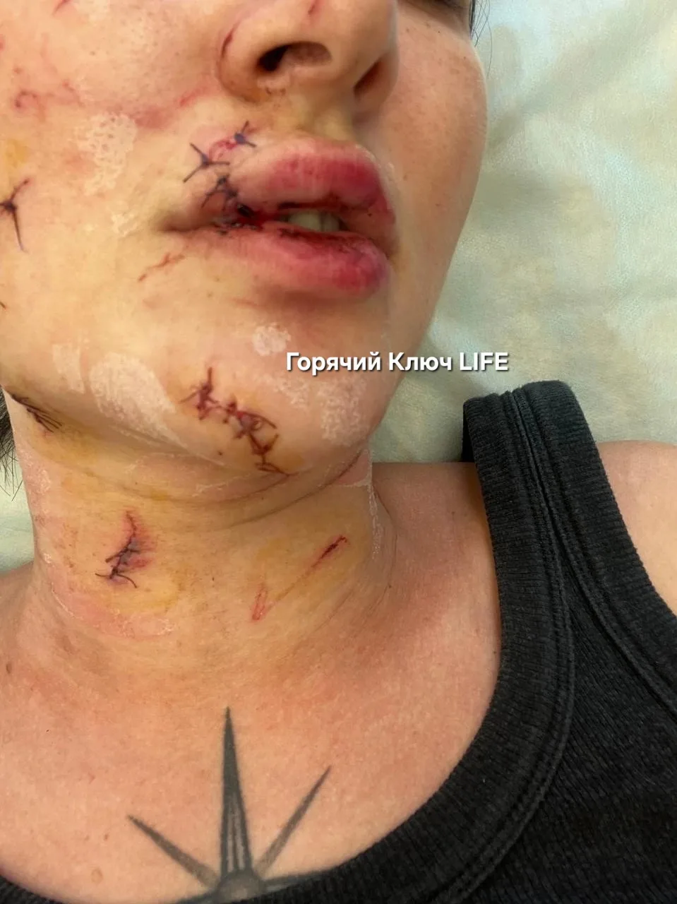 Здравствуйте, Ирина! Хотим с помощью ваших пабликов осветить происшествие, которое случ...