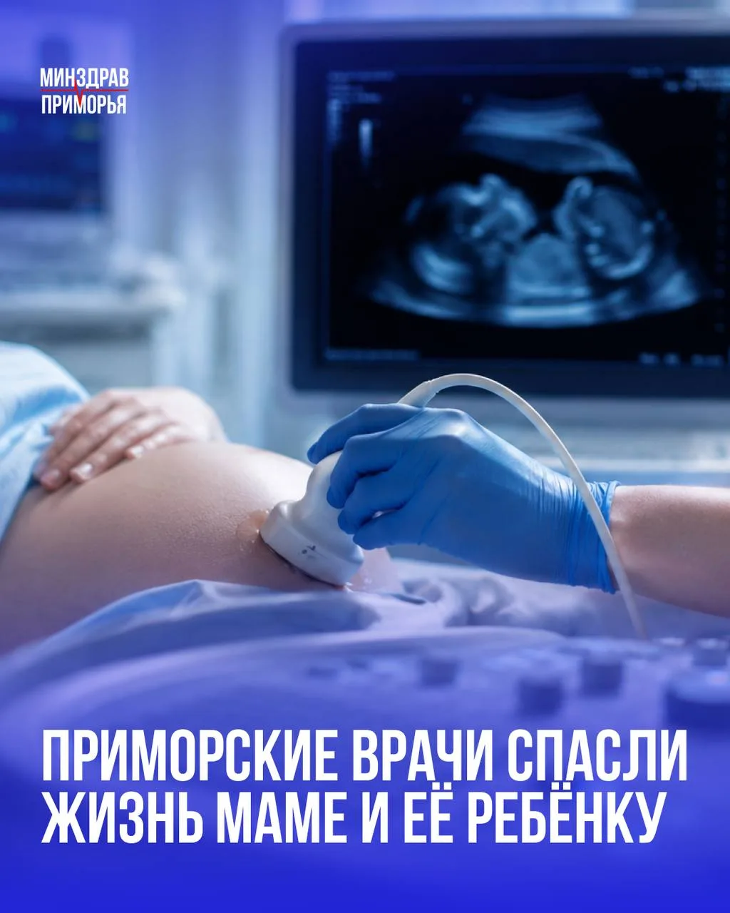 Во Владивостоке специалисты Приморской краевой клинической больницы №1 помогли 23-летней женщине на 