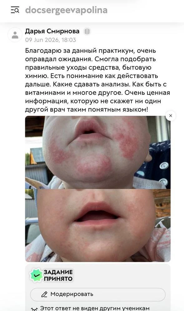 Отзыв с практикума Прощай, дерматит и аллергия.