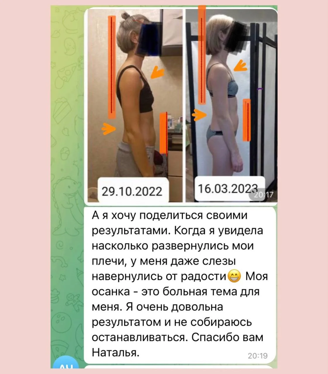 Холка на шее и выдвинутая голова вперед.