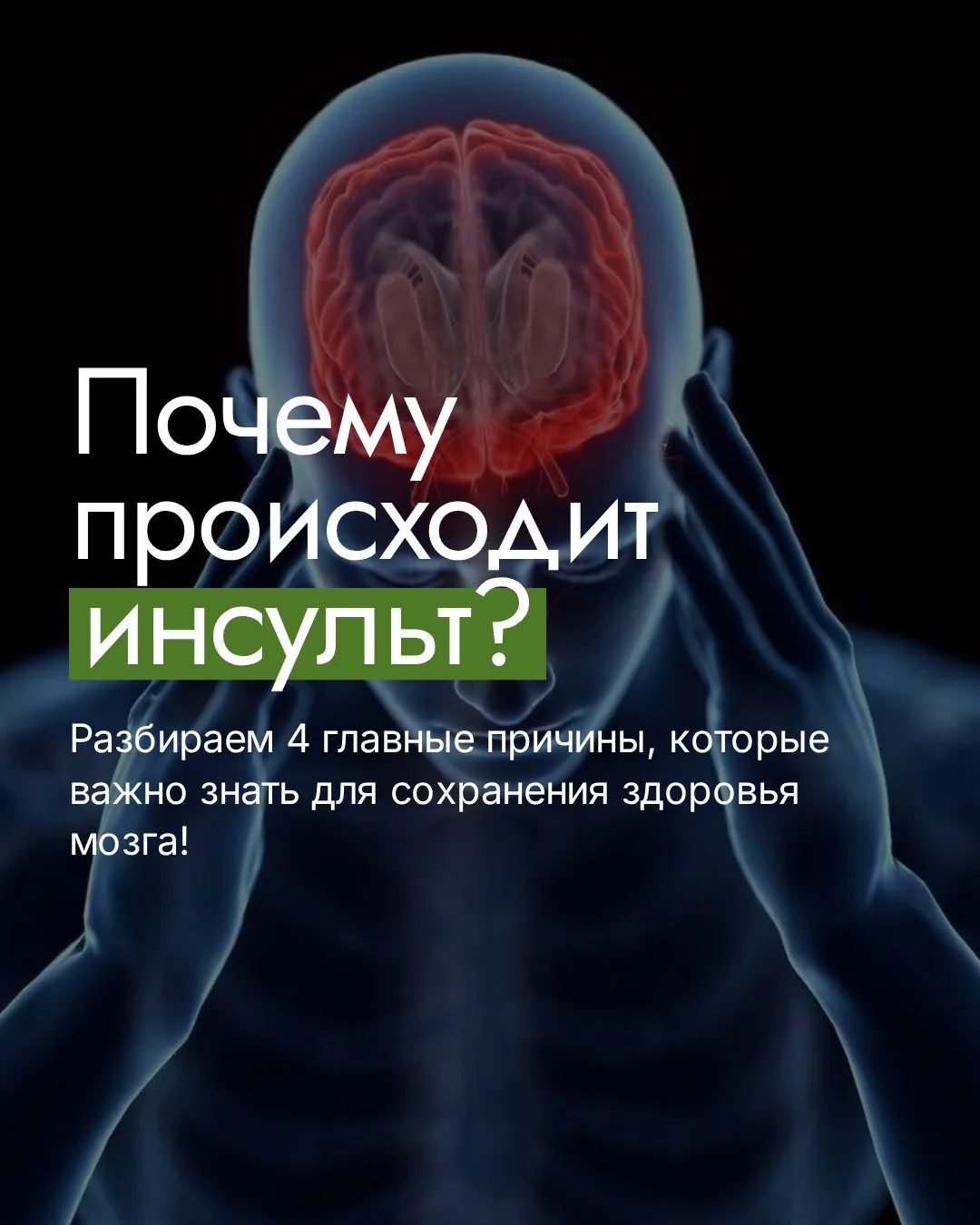 Инсульт не приходит «просто так». У него всегда есть физиологическая причина 🧠