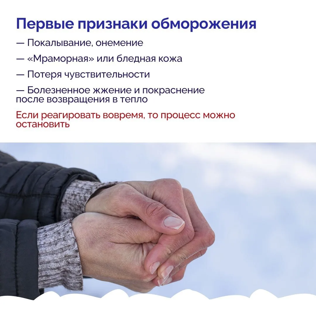 Зимой риск обморожений особенно высок — даже при небольшом минусе за окном холод, ветер и влажность 