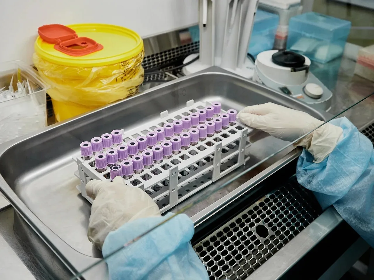 Более 730 000 жителей Подмосковья прошли тестирование на ВИЧ с начала года   ✅ В регионе это можно с