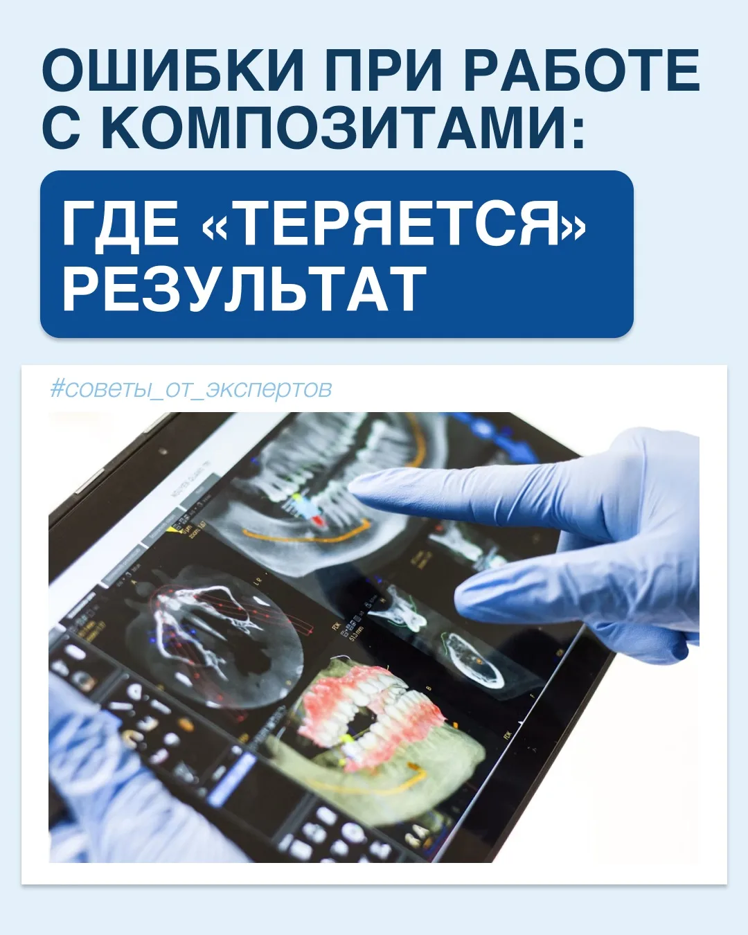 🦷Даже качественный композит не гарантирует идеальную реставрацию. На итоговый результат влияет множ