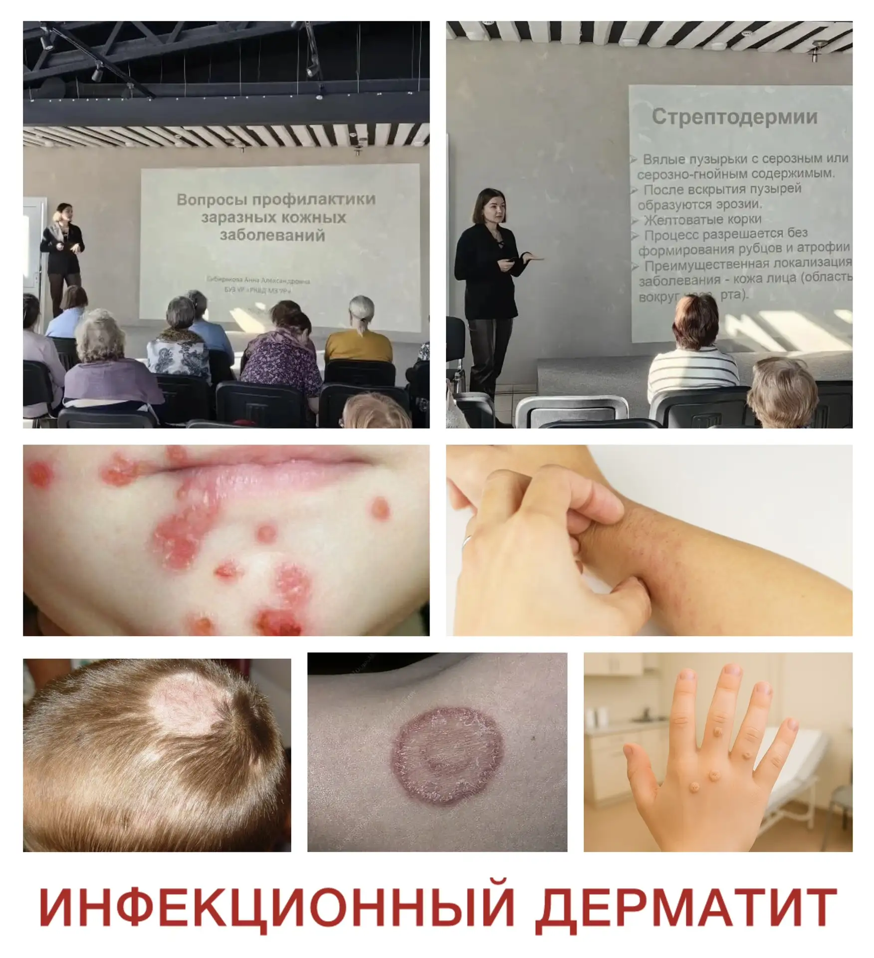 Почему риск заразиться кожными инфекциями возрастает именно весной?