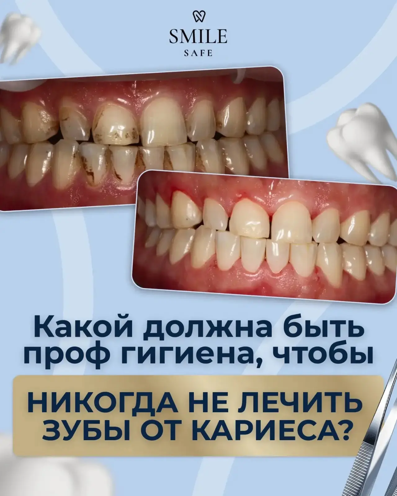 Заманчивая идея - не тратить время и деньги на профилактику. Пока ничего не болит, заче...