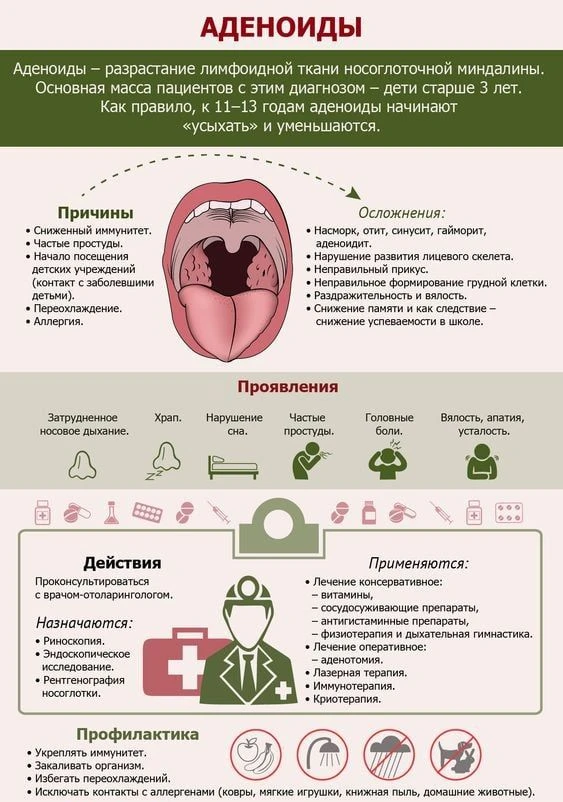 Аденоиды