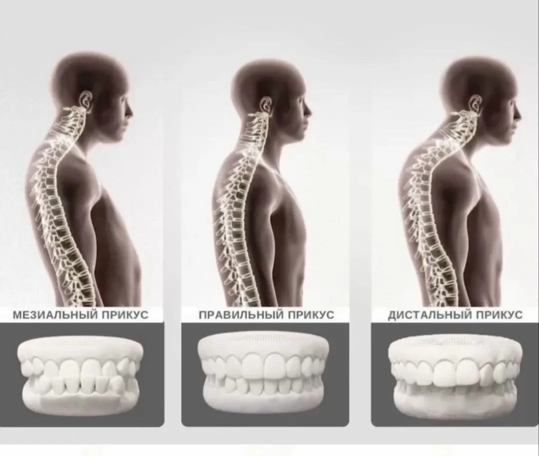 🦷 Ваша осанка начинается с прикуса! 🤔

Постоянно сутулитесь? Шея затекает к концу дня, а поясница 