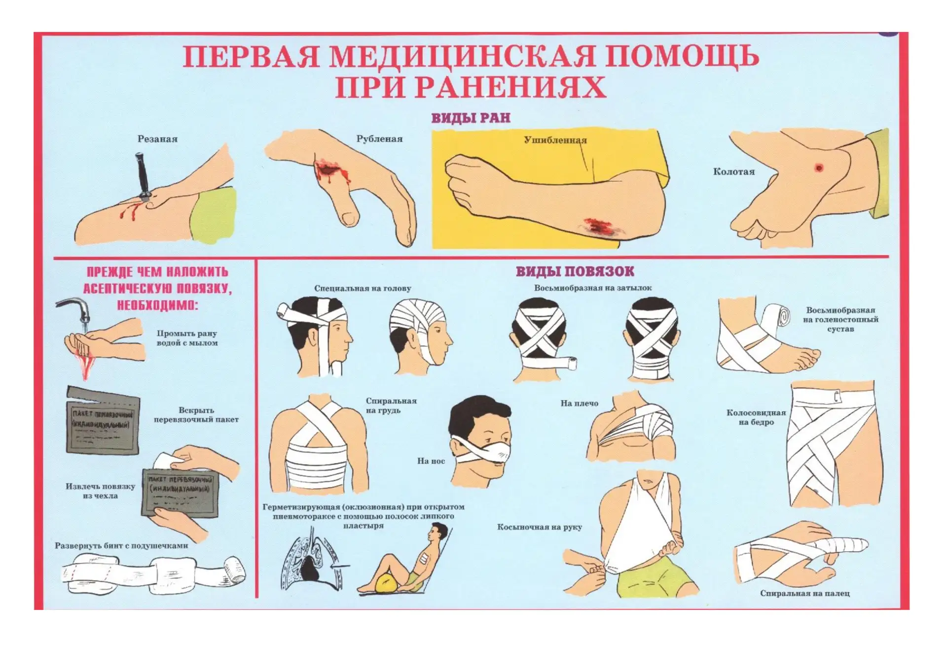 Дорогие друзья, повторяем правила оказания первой медицинской помощи при ранениях, травмах.